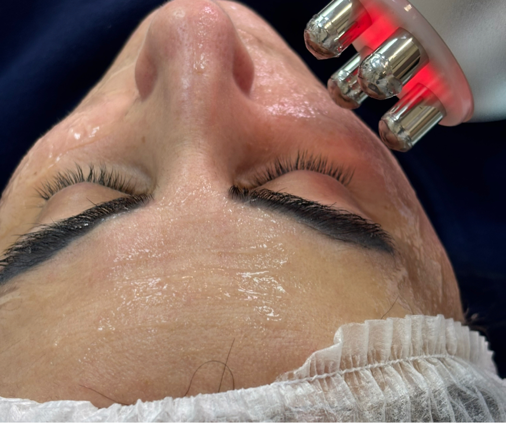 РФ лифтинг для тела