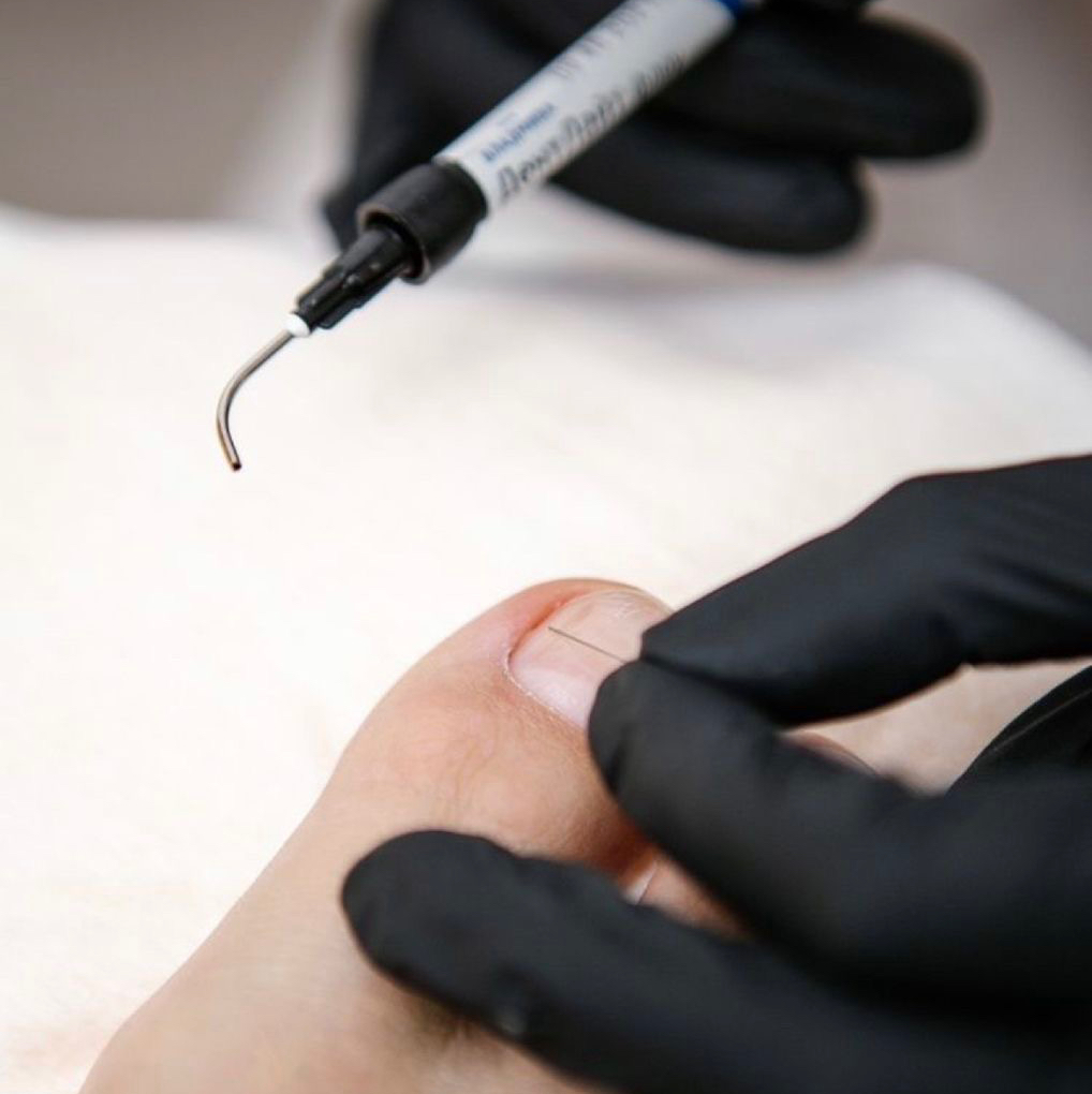 Педикюр подологический