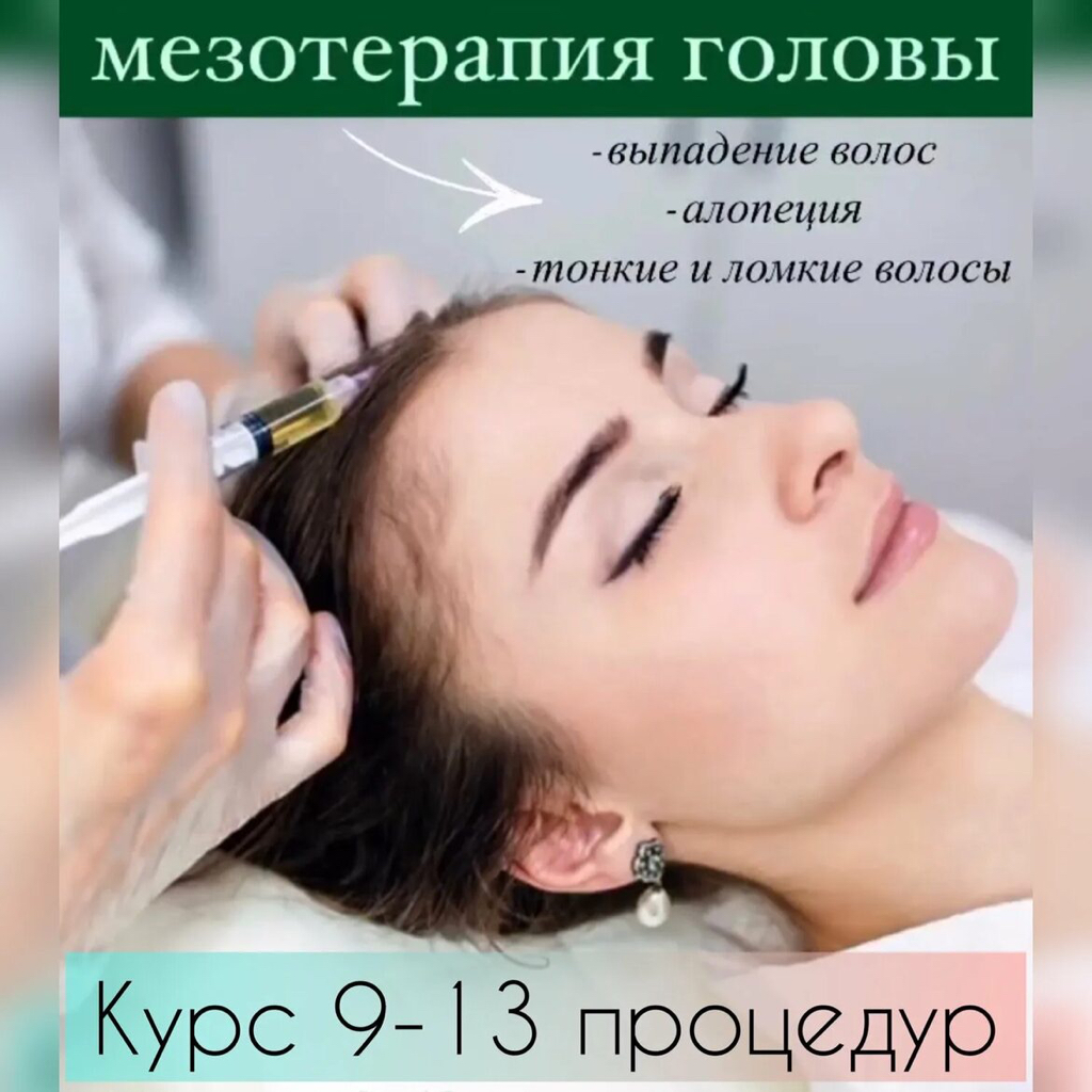 Мезотерапия волосистой части головы