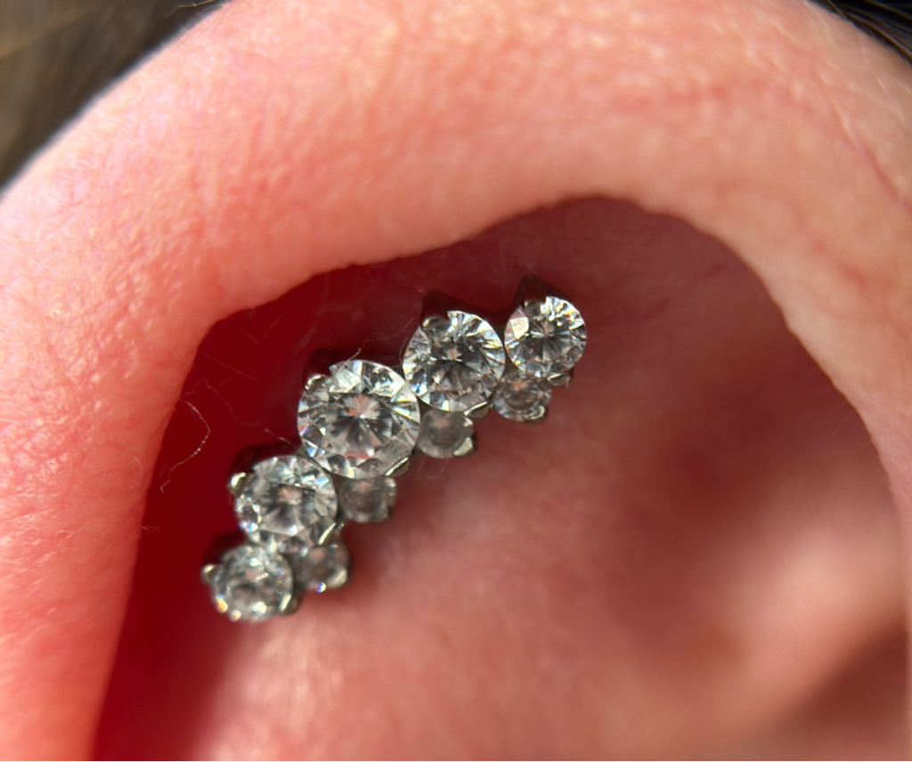 Восстановоение прокола