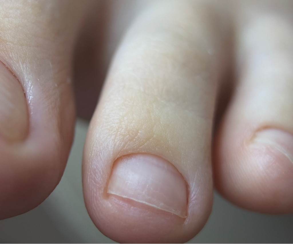 Обработка стопы и пальцев БЕЗ покрытия