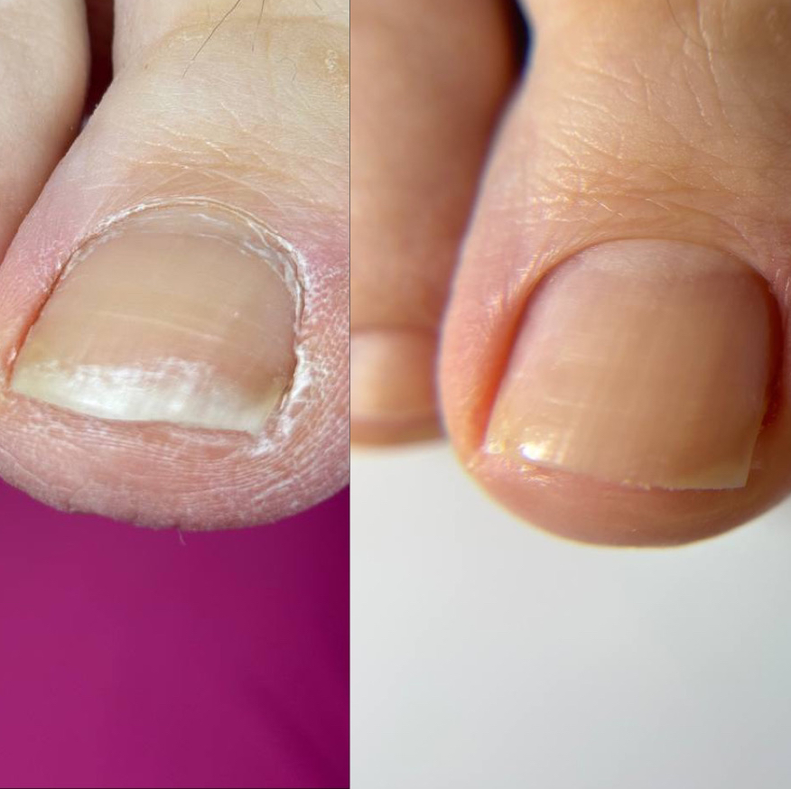 МУЖСКОЙ ПЕДИКЮР (обработка стопы, пальцев+уход)