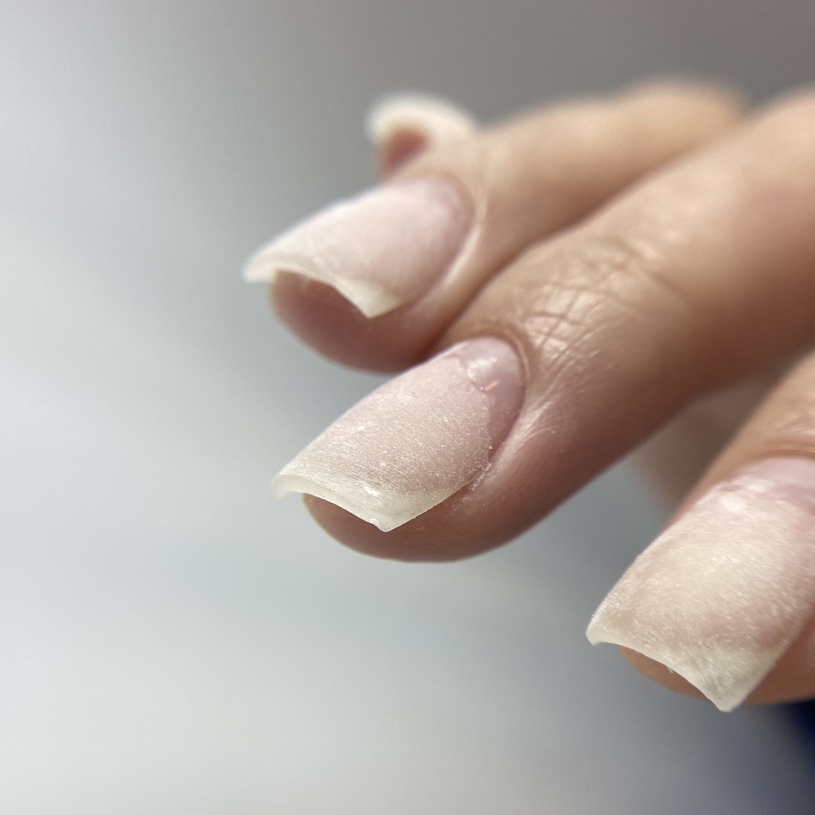 Донаращивание