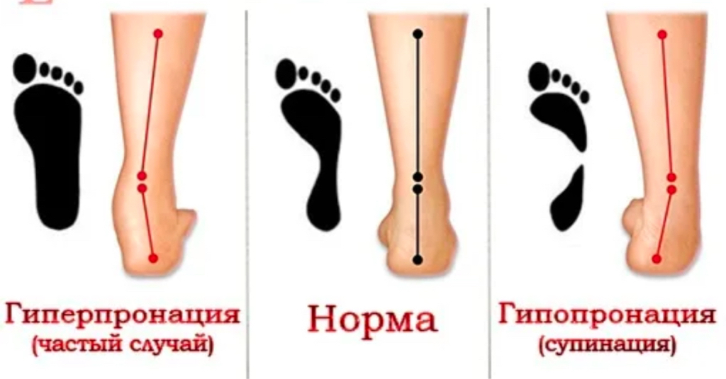 Кинезиомассаж  (таз+ноги+стопы)