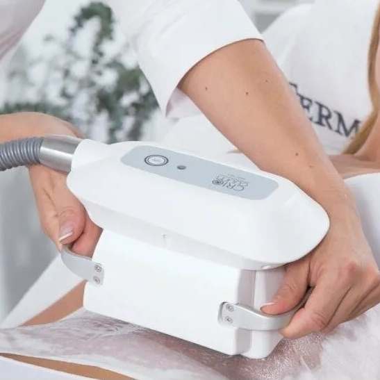 Криолиполиз (1 насадка)