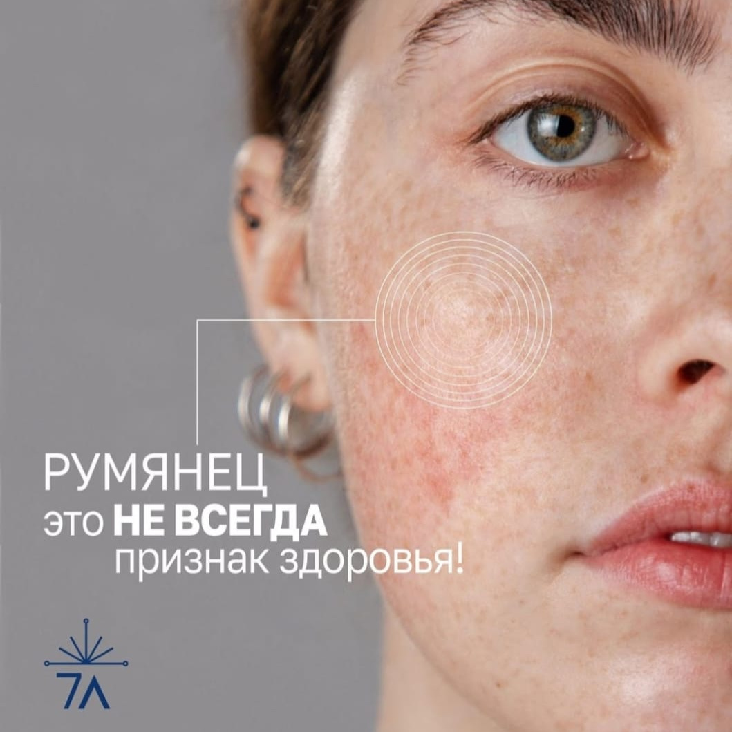 Успокаивающий уход Гомео Роз от Натинуэль (Италия)
