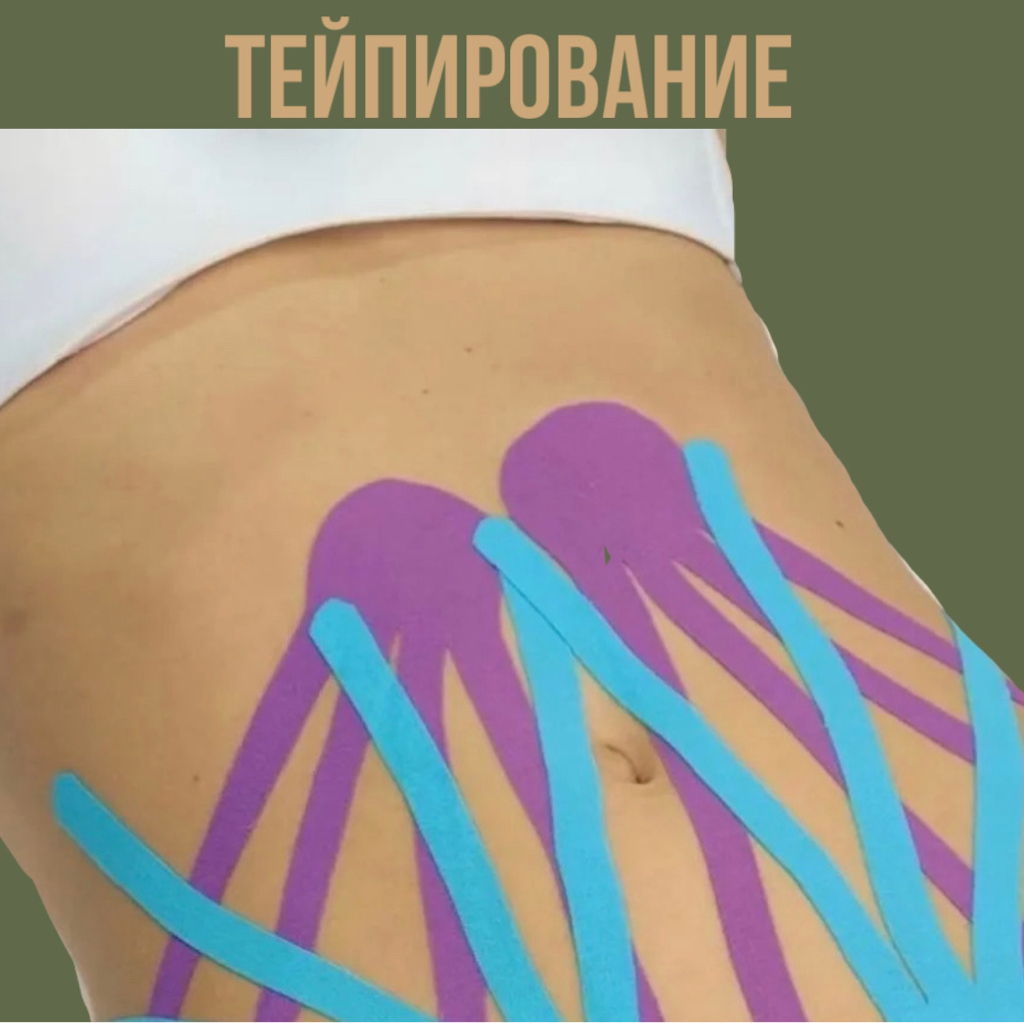 Тейпирование