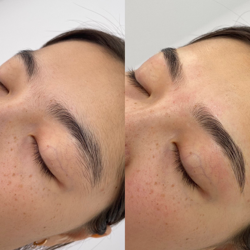 Мусульманская коррекция без покраски