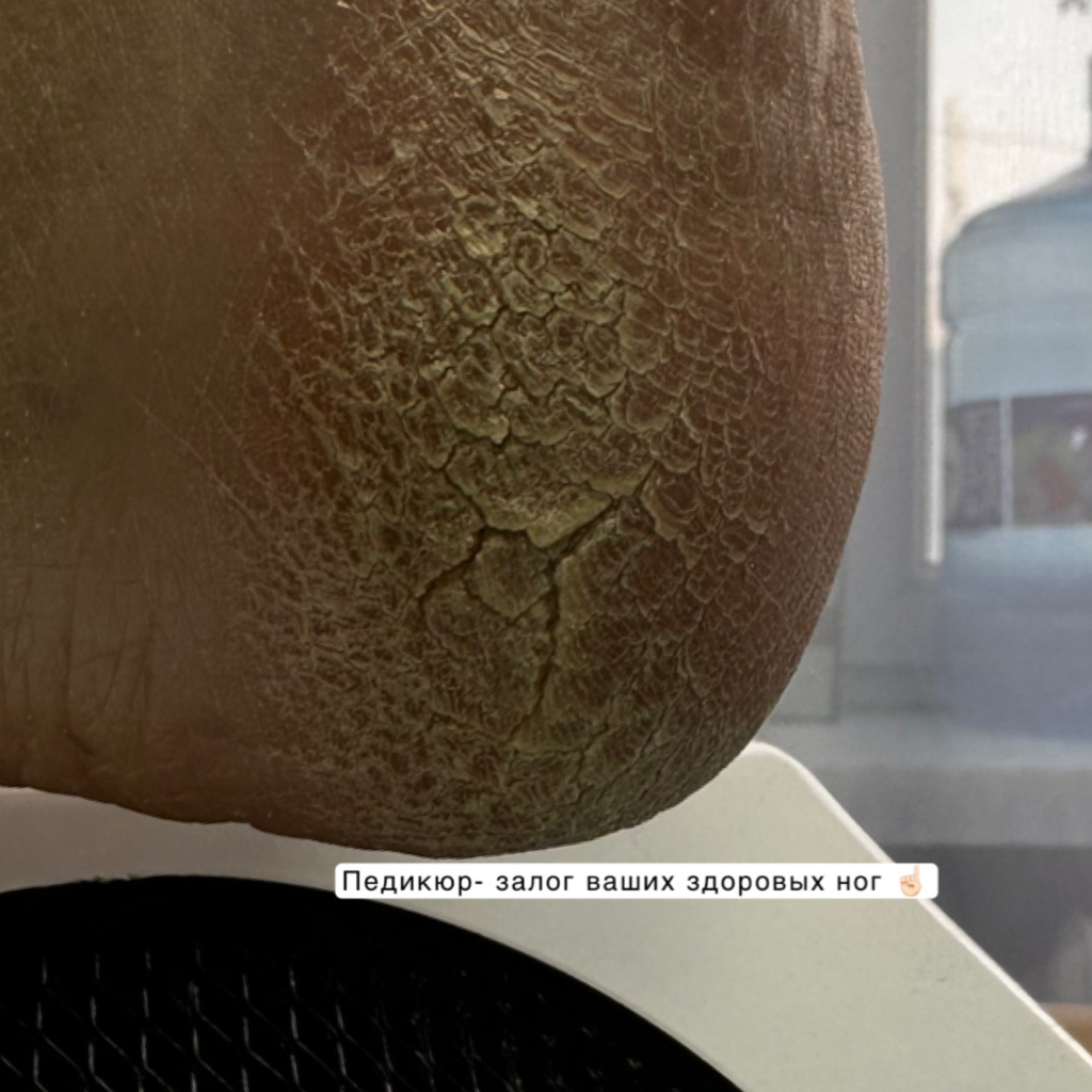 Педикюр полностью