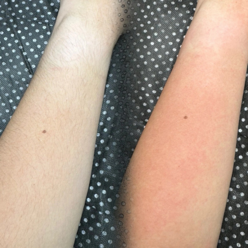 Руки до локтя