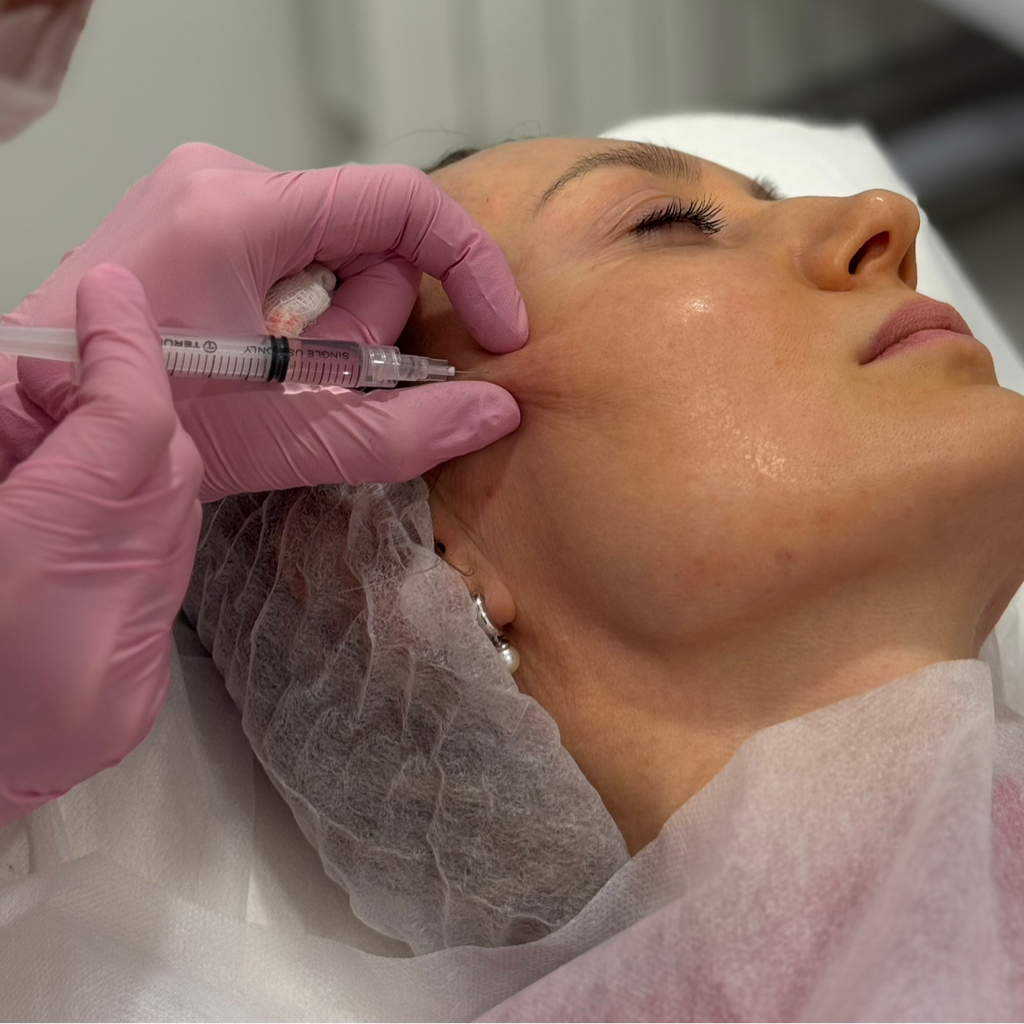 Биоревитализация Citolife 2,0 Skinpro forte