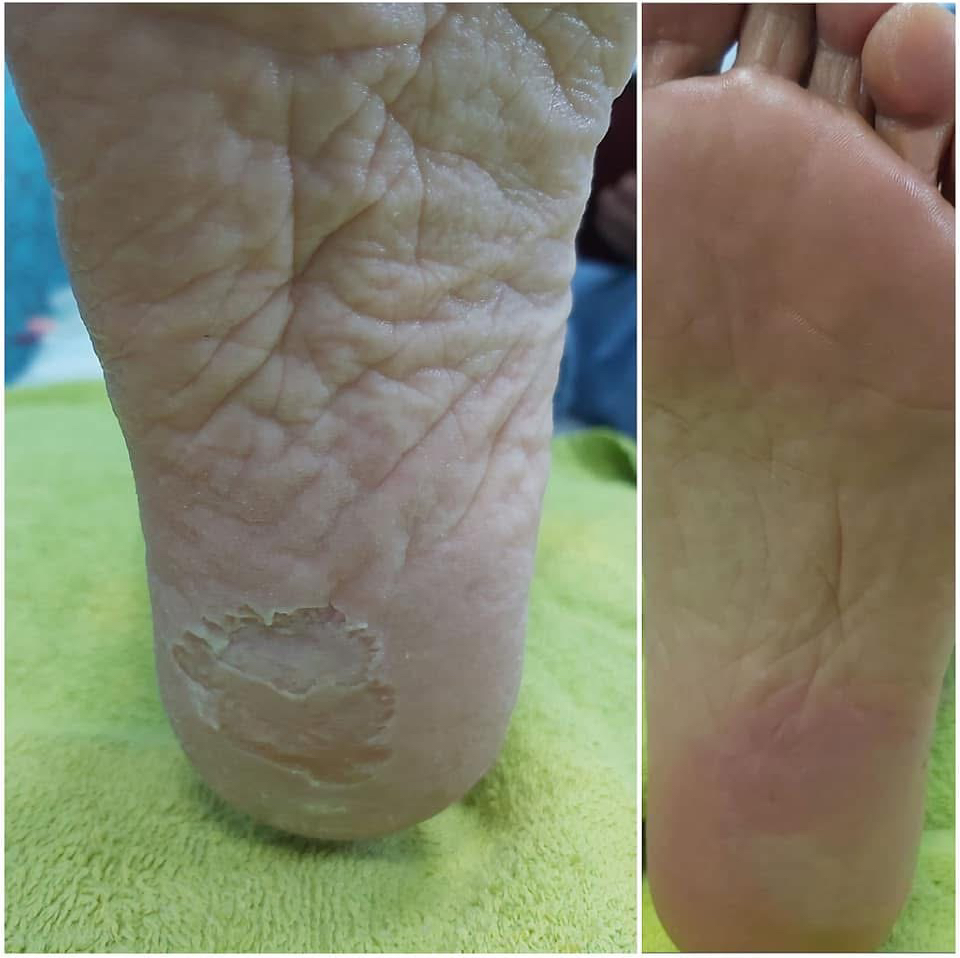 Smart педикюр