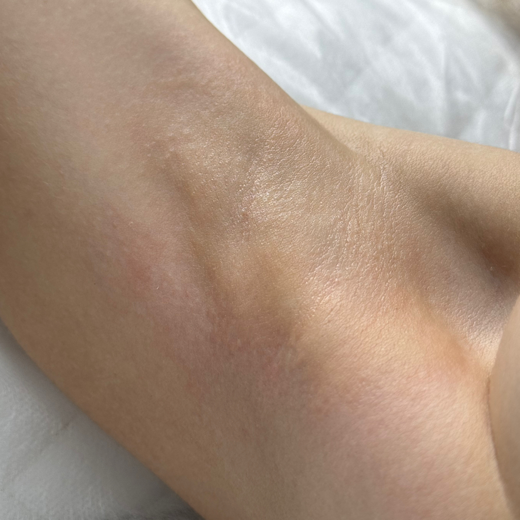 Подмышечные впадины