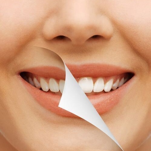Отбеливание зубов