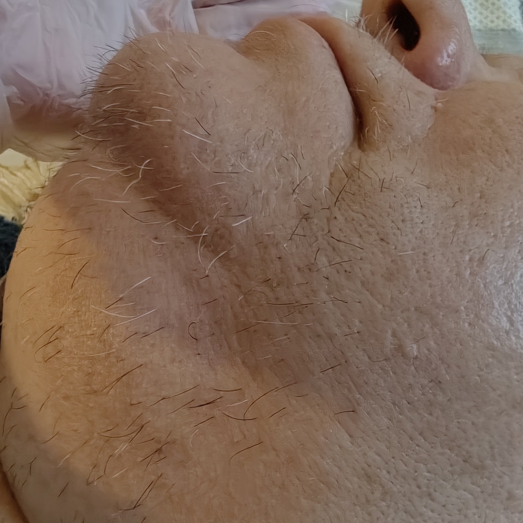 Подбородок