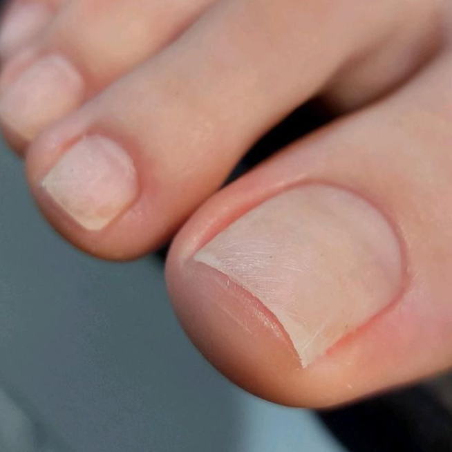 Педикюр без покрытия пальчики