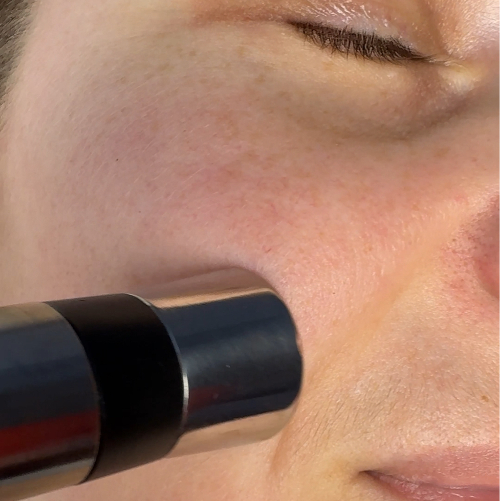 Электропорация с концентратом Skeyndor по проблеме кожи