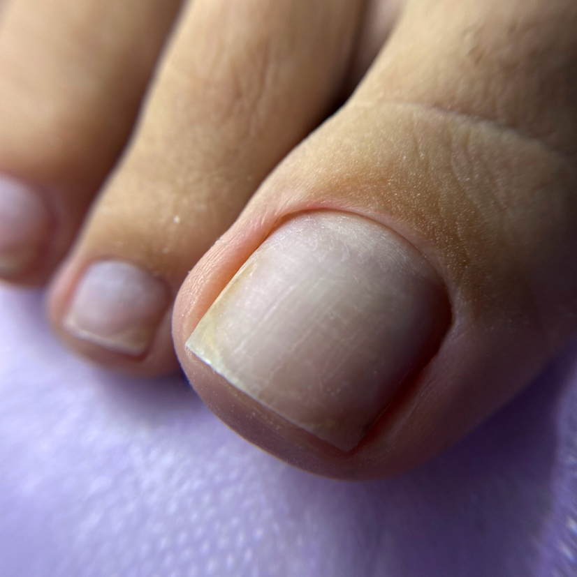 Гигиеническая обработка пальчиков /без стопы и покрытия