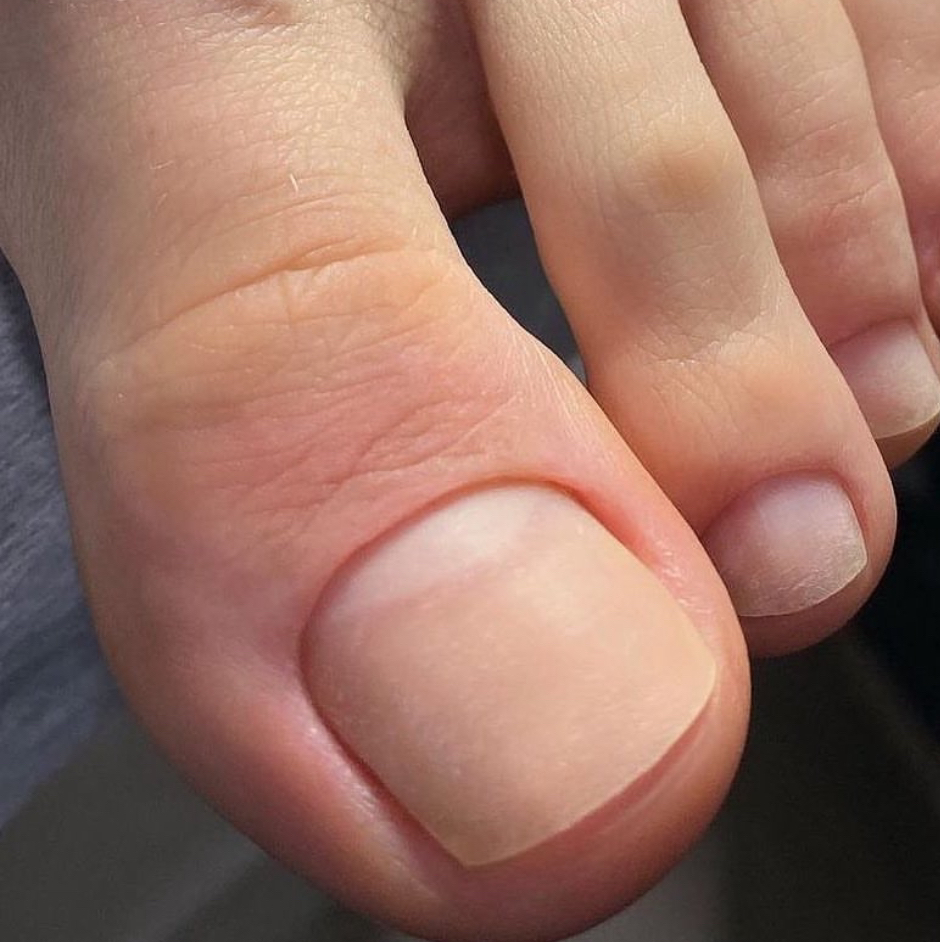 Обработка пальчиков без покрытия