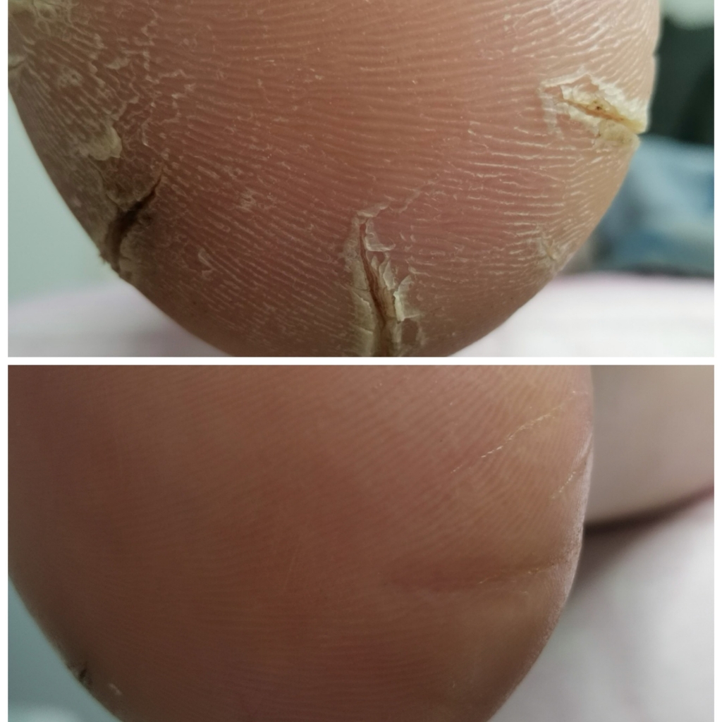 Убрать трещины