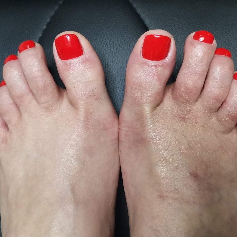 Обработка пальчиков на ноге с покрытием гель-лак