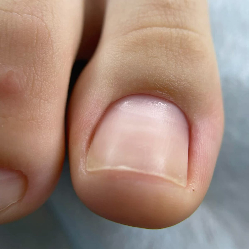 Гигиенический дисковый-педикюр