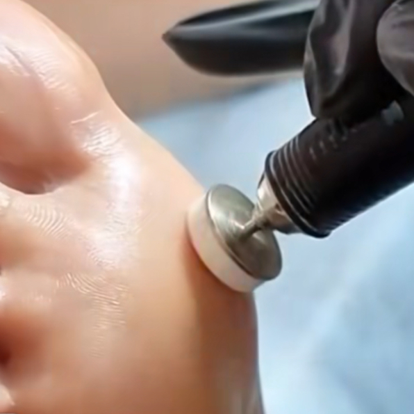 Дисковая-обработка стоп