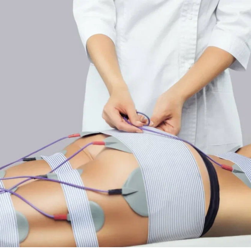 Миостимуляция