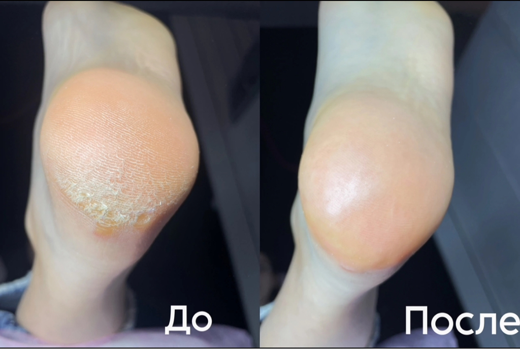 педикюр полный (обработка стопы и пальчиков БЕЗ покрытия)