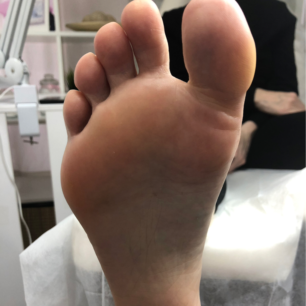 Смарт педикюр обработка стопы и пальчиков