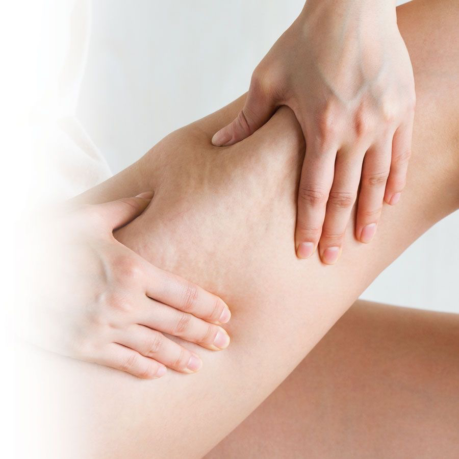 Антицеллюлитный массаж 90 мин