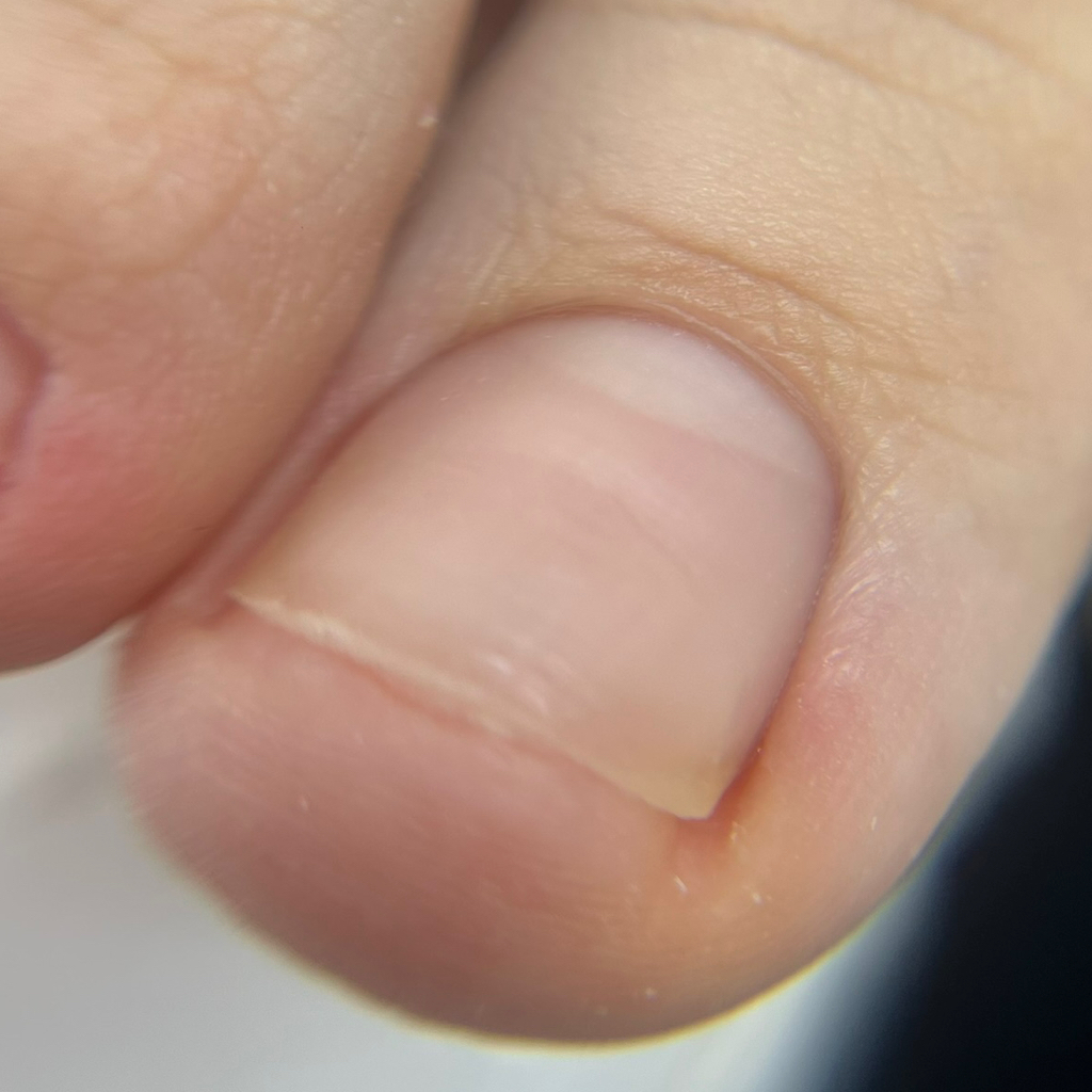 Педикюр без покрытия. Отбработка сложных стоп + 3000тг.