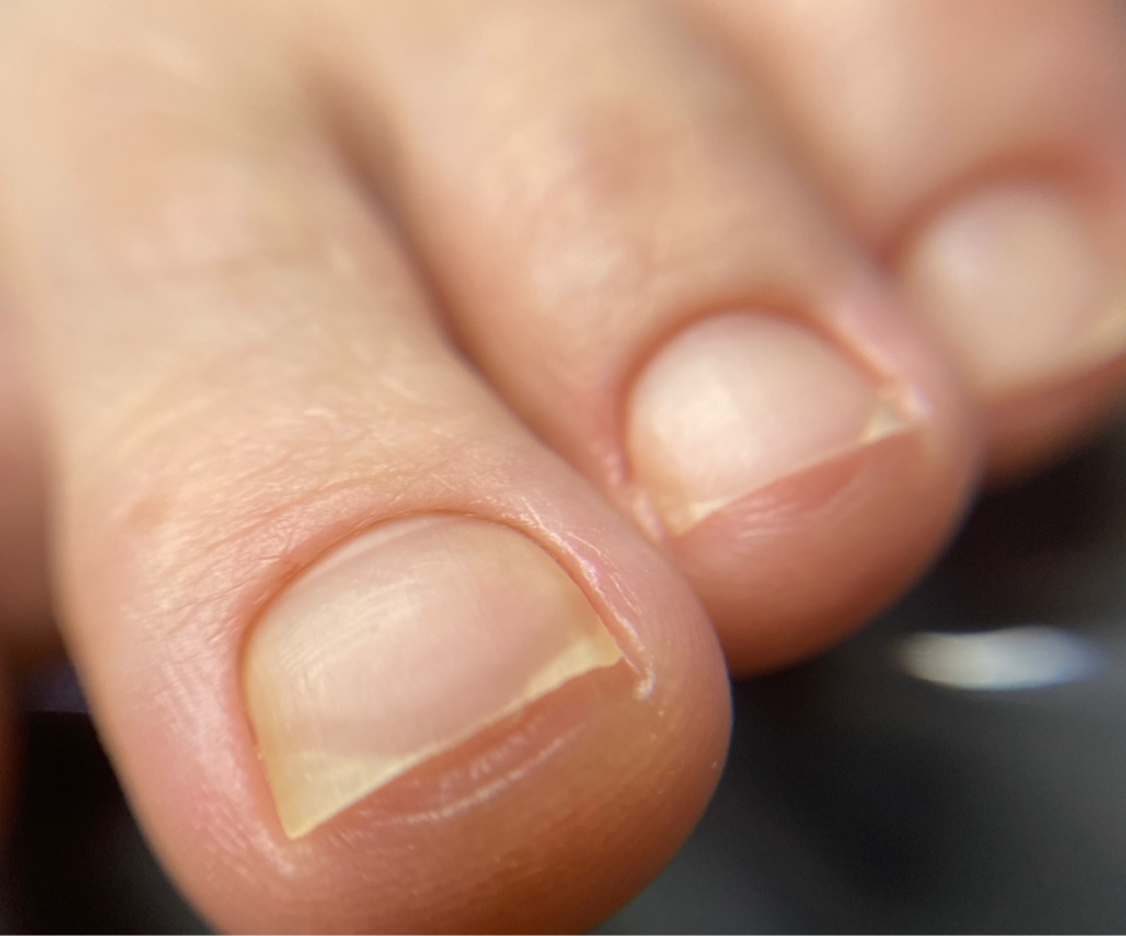 Педикюр пальчики без покрытия