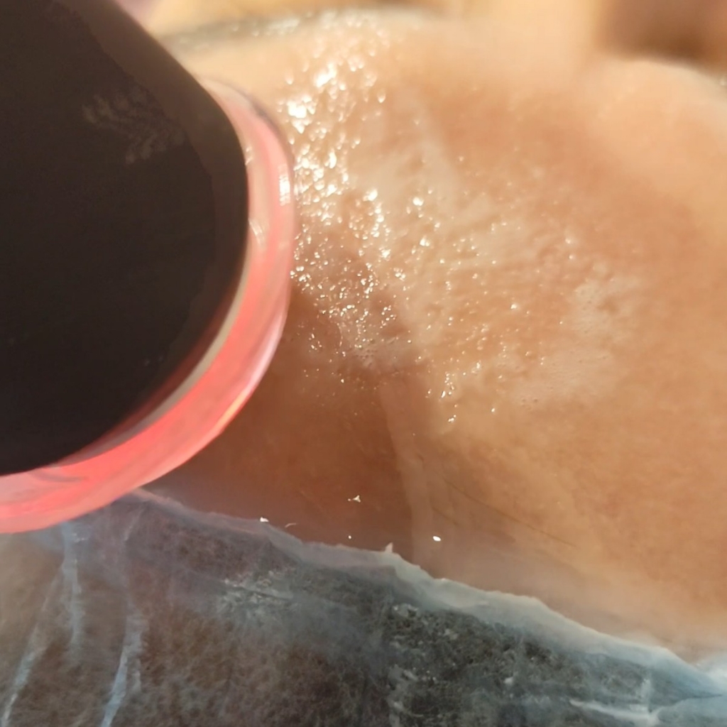 БМС + Карбокси терапия аппаратная