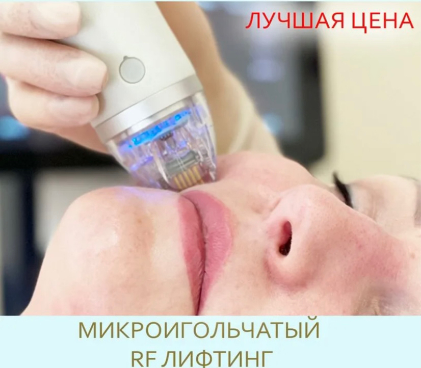 Микроигольчатый RF лифтинг