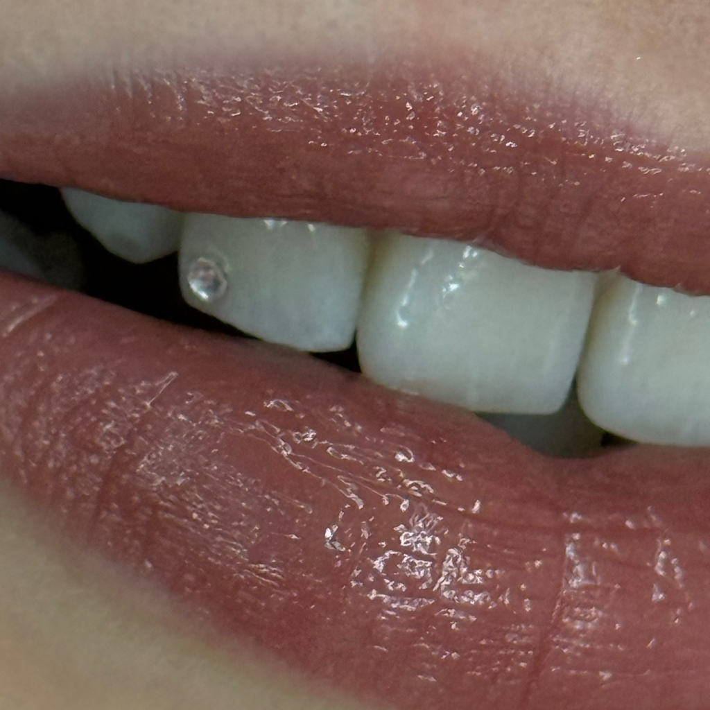 Скайсы (страз на зуб)