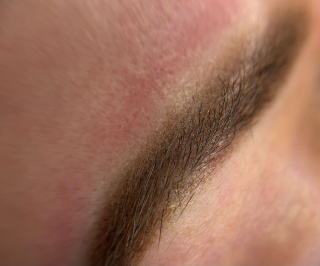 Коррекция бровей- через 2 месяца