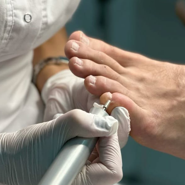 Мужской пальчиковый педикюр