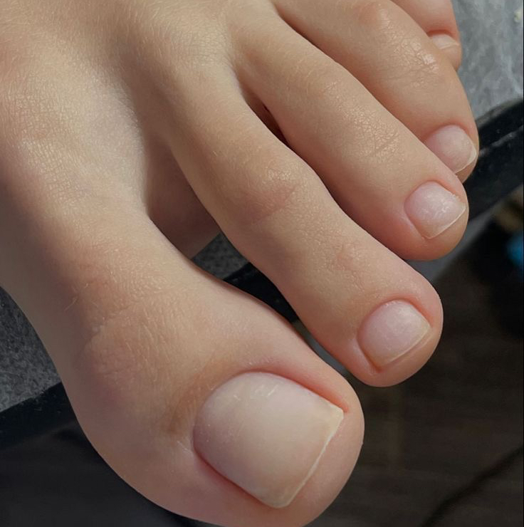 Снятие гель-лака(педикюра)