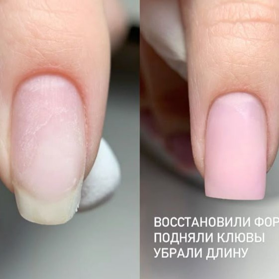 Востановление формы ногтей гелем (трещины, углы, клюющие)