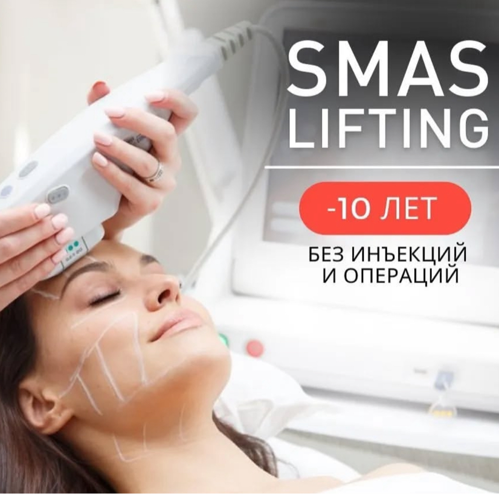 SMAS -Лифтинг