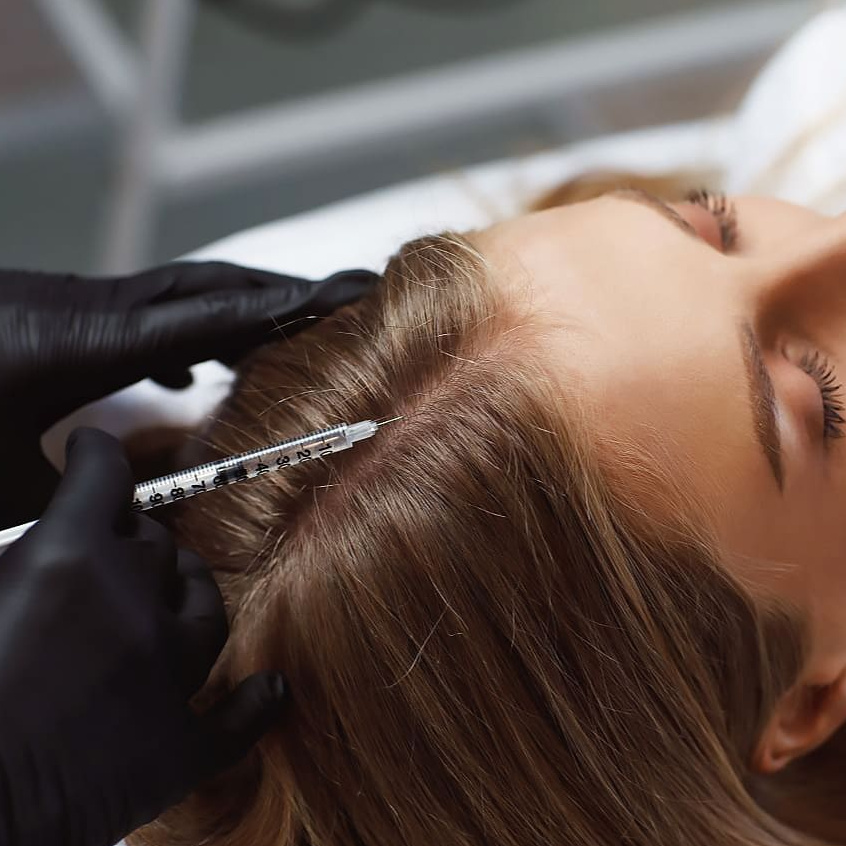 Мезотерапия головы (волосяная часть) Препарат Hair+