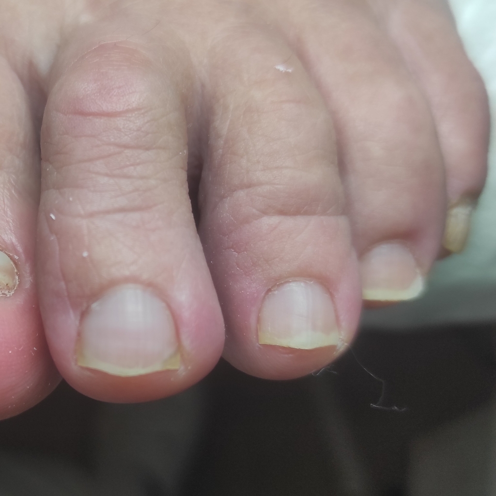 Подстричь ногти на ногах без педикюра