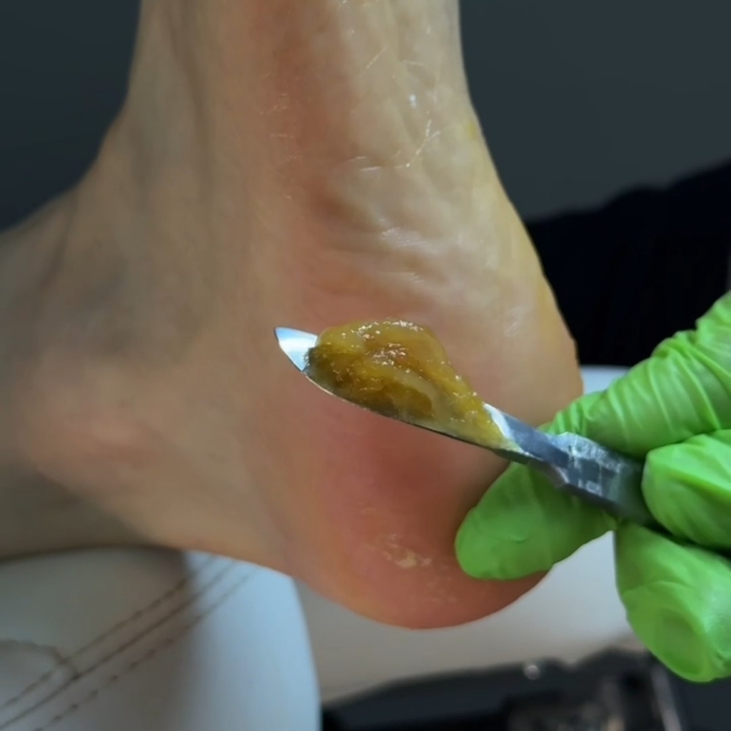 KART педикюр Израиль обработка только подошвенной части стопы