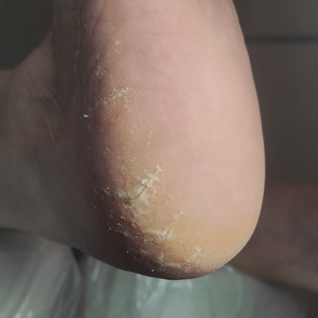 Доплата за сложности при педикюре