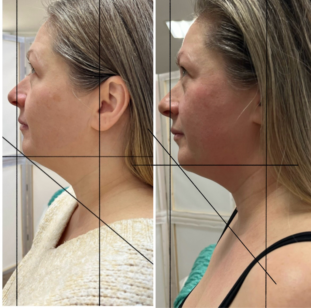 Авторский метод оздоровления и омоложения лица «bauty face fit” Длительность до 90 минут
