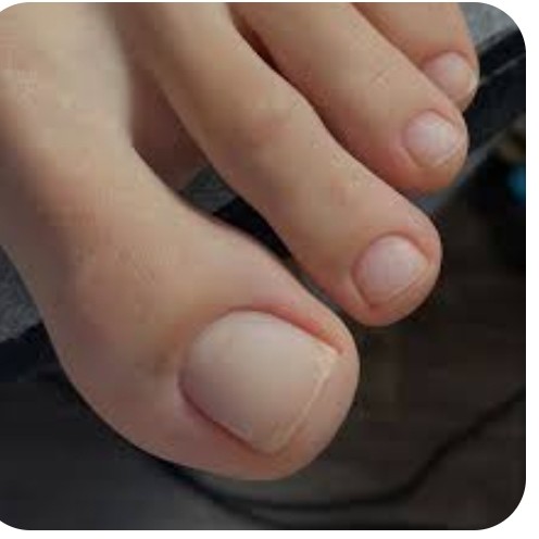 Педикюр гигиенический - без покрытия