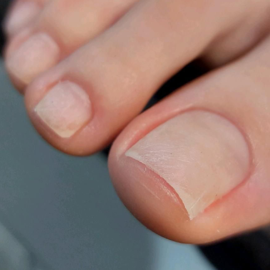 Педикюр пальчиков без покрытия