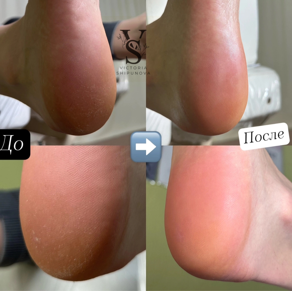 Педикюр всей стопы с покрытием