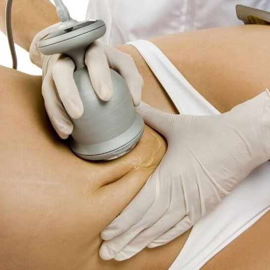 Кавитация живота и талии